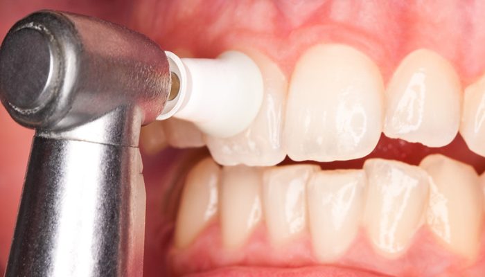 dentist-oradea-royalsmileclinic